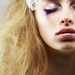 Blindheit